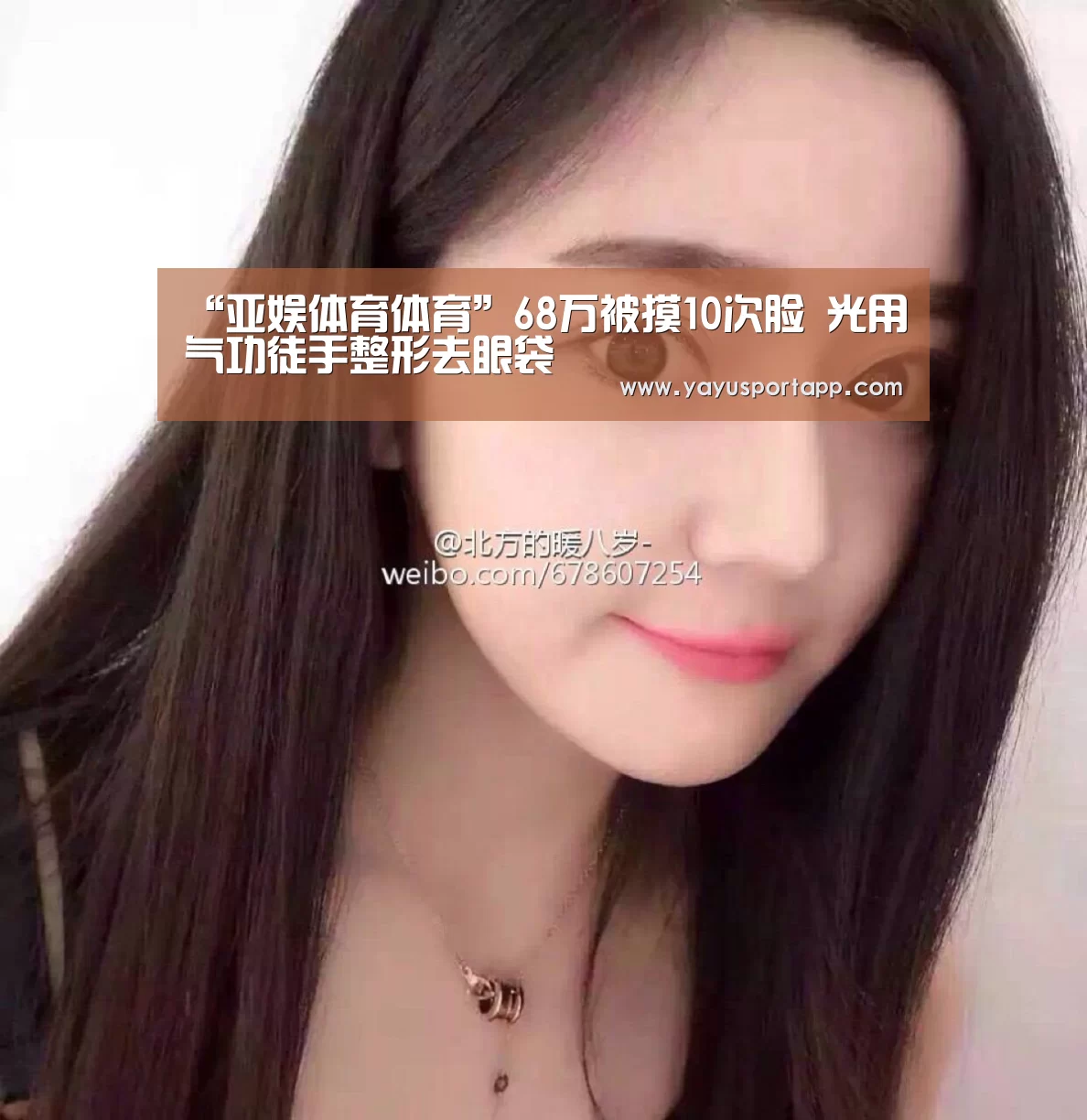 “亚娱体育体育”68万被摸10次脸 光用气功徒手整形去眼袋(图1) 亚娱体育官网